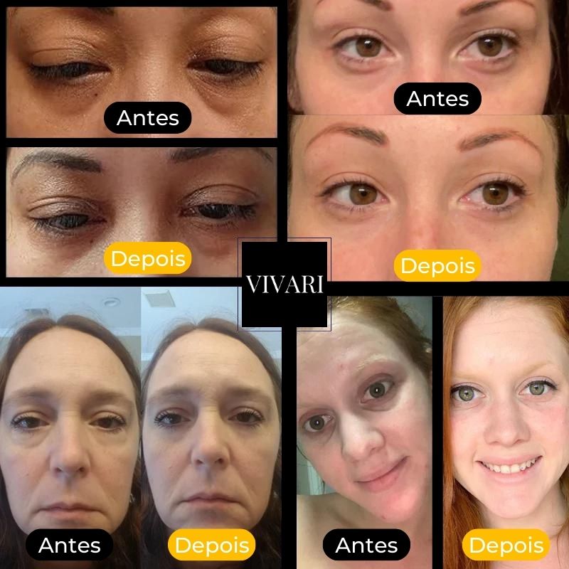 Bellari Face Pro©